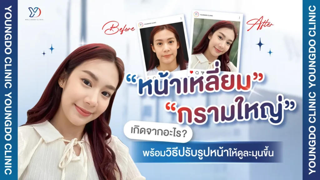 หน้าเหลี่ยม กรามใหญ่ เกิดจากอะไร รวมวิธีปรับหน้าให้ดูละมุนขึ้น