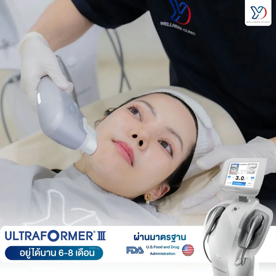 ยกกระชับใบหน้าด้วย Ultraformer III