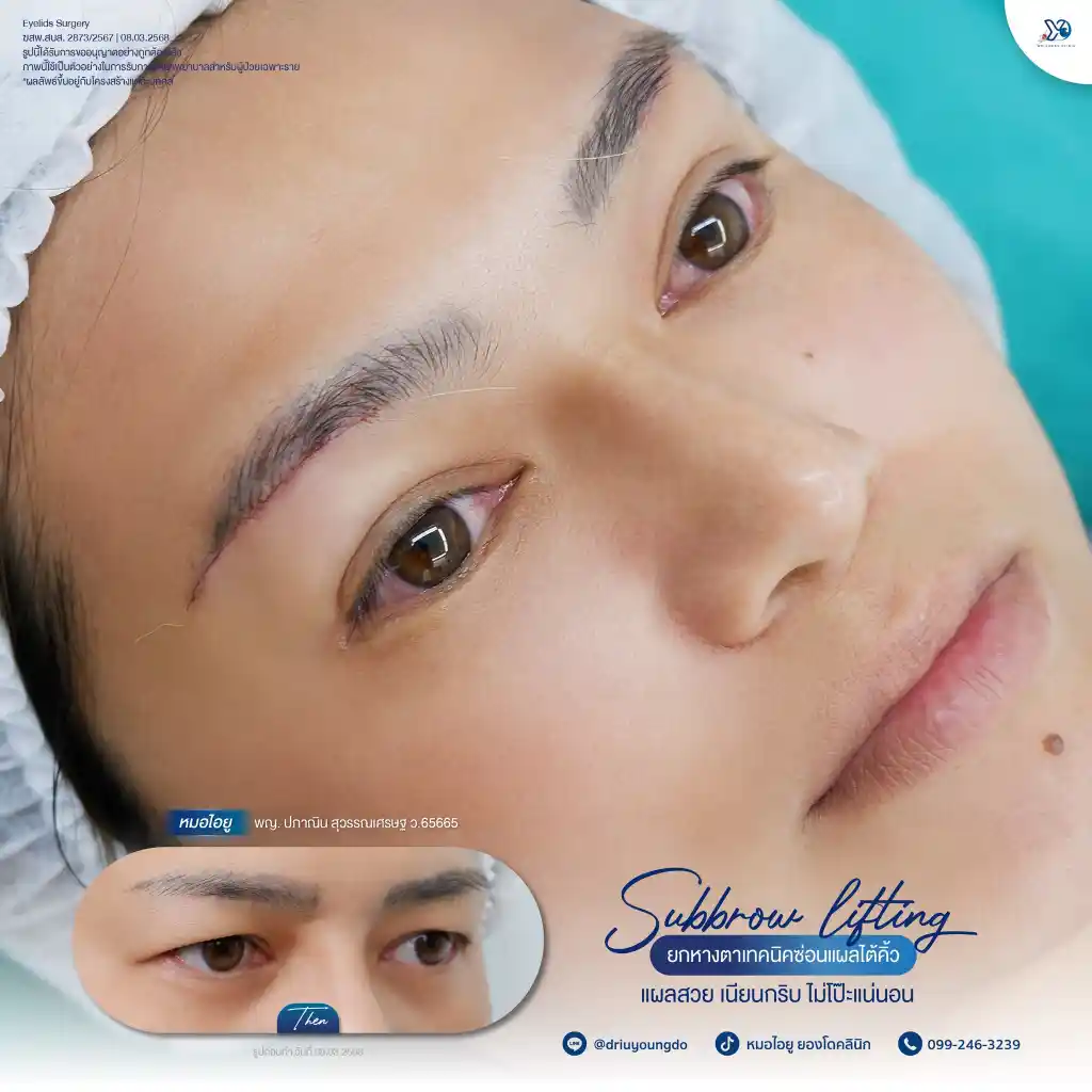 ดวงตาดุมีลักษณะอย่างไร