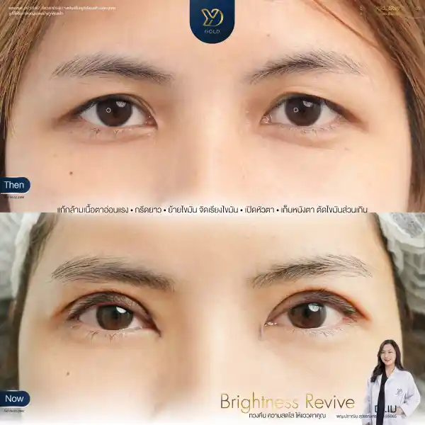 วิธีเปลี่ยนตาดุให้ตาสวยหวาน