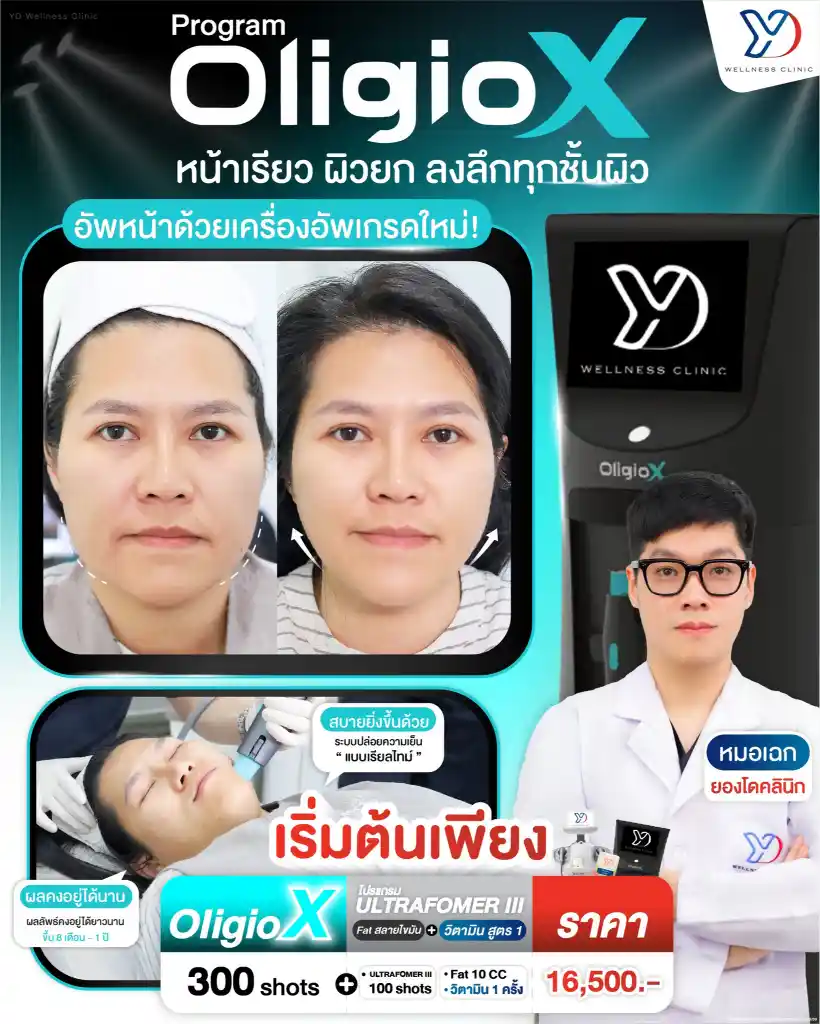 UltraGio X คืออะไร