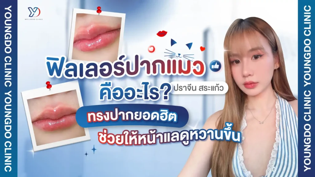 ฟิลเลอร์ปากแมว ปราจีน สระแก้ว คืออะไร? ทรงปากยอดฮิตที่ช่วยให้หน้าดูหวานขึ้น