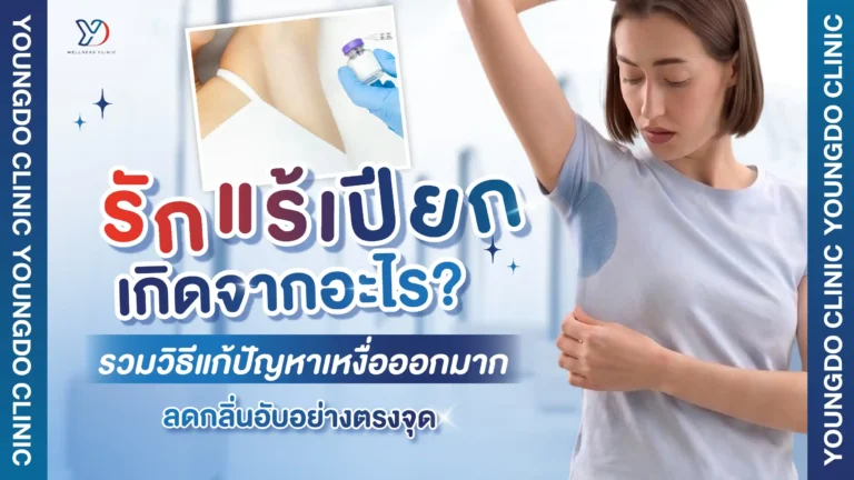 รักแร้เปียก เกิดจากอะไร? รวมวิธีแก้ปัญหาเหงื่อออกมาก ลดกลิ่นอับอย่างเหมาะสม