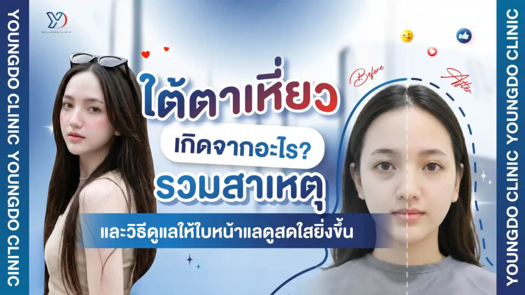 ใต้ตาเหี่ยว เกิดจากอะไร? รวมสาเหตุและวิธีดูแลให้ใบหน้าดูสดใสยิ่งขึ้น
