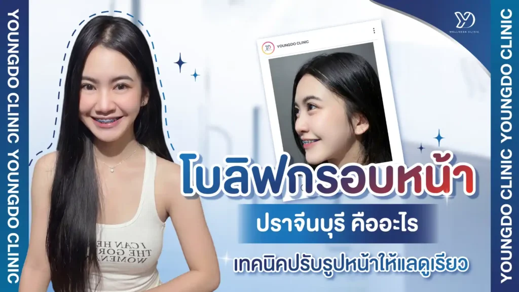 ฉีดโบลิฟกรอบหน้า ปราจีนบุรี คืออะไร? เทคนิคปรับรูปหน้าให้แลดูเรียว กรอบหน้าชัดแบบมีมิติธรรมชาติ