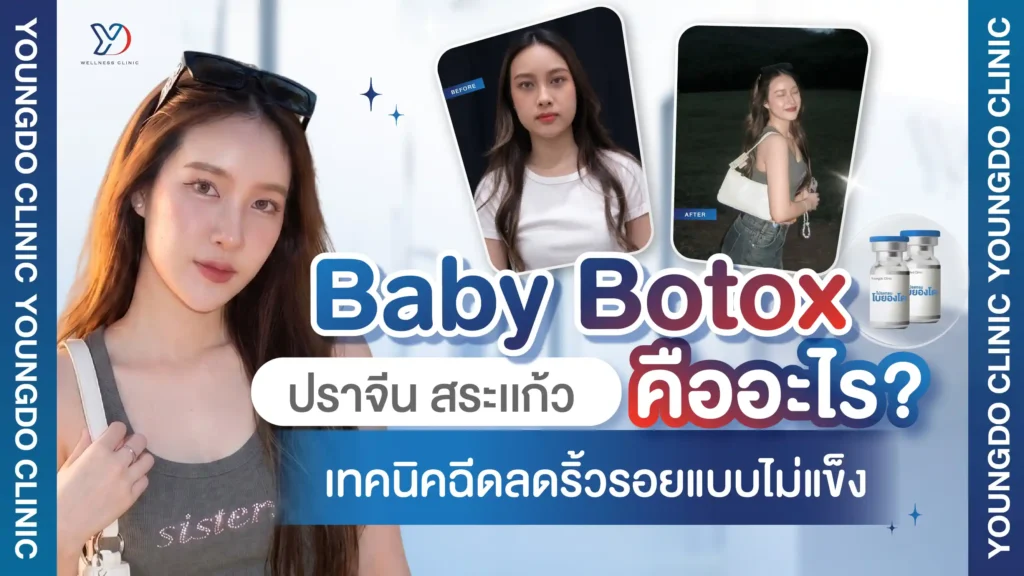 Baby Botox ปราจีนบุรี-สระแก้ว คืออะไร? เทคนิคฉีดลดริ้วรอยแบบไม่แข็ง