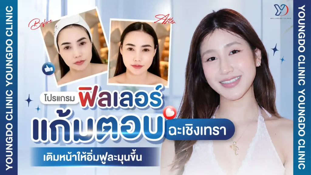 โปรแกรมฟิลเลอร์แก้มตอบ ฉะเชิงเทรา เติมหน้าให้อิ่มฟูละมุนขึ้น