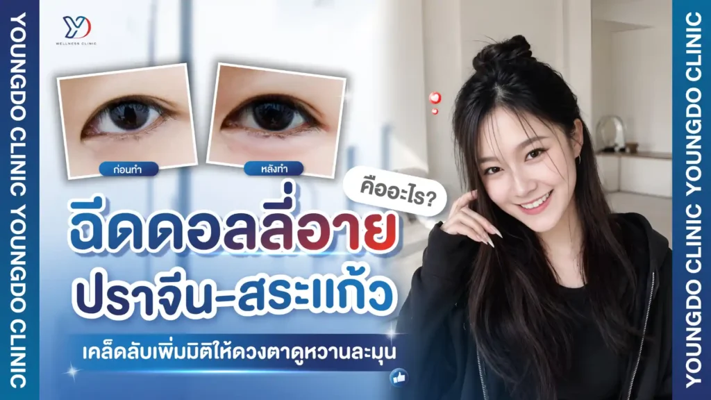 ฉีดดอลลี่อาย ปราจีน สระแก้ว คืออะไร? เคล็ดลับเพิ่มมิติให้ดวงตาดูหวานละมุน