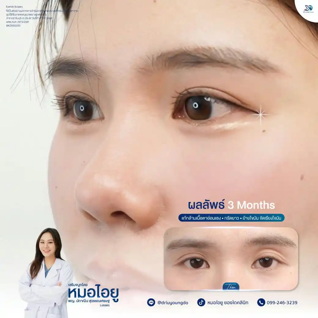 ทำตากับจมูกพร้อมกัน