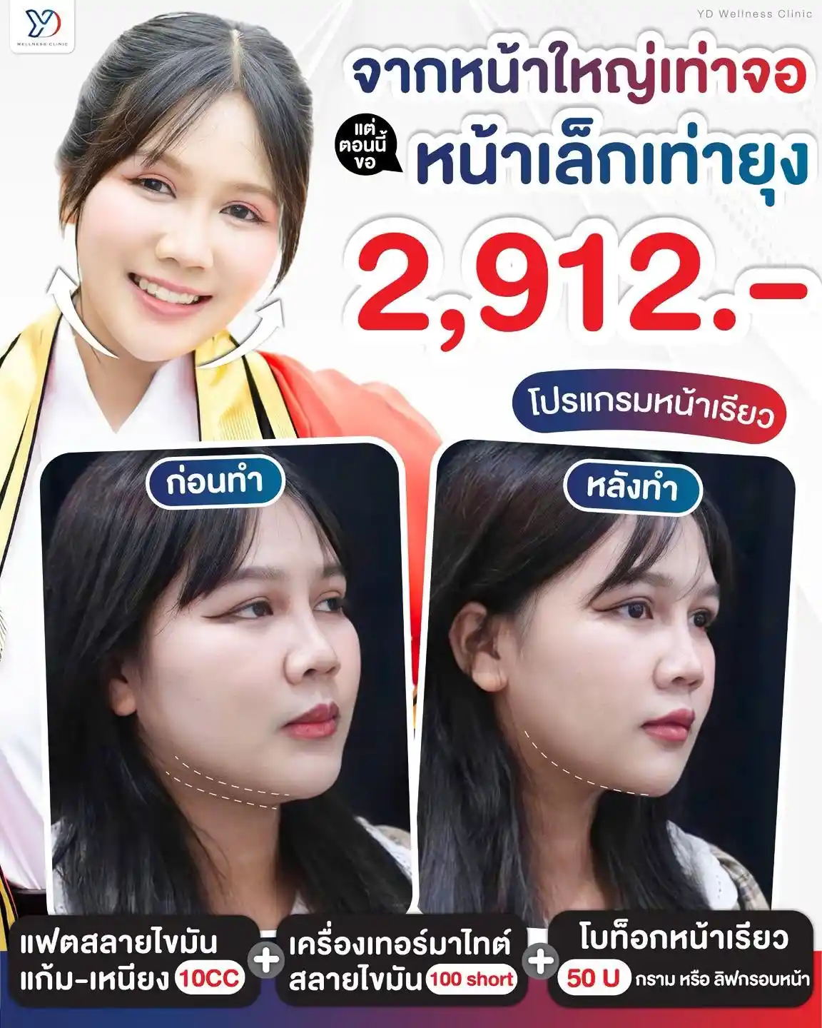 วิธีปรับรูปหน้าตามเทรนด์หน้ายุง ปราจีน
