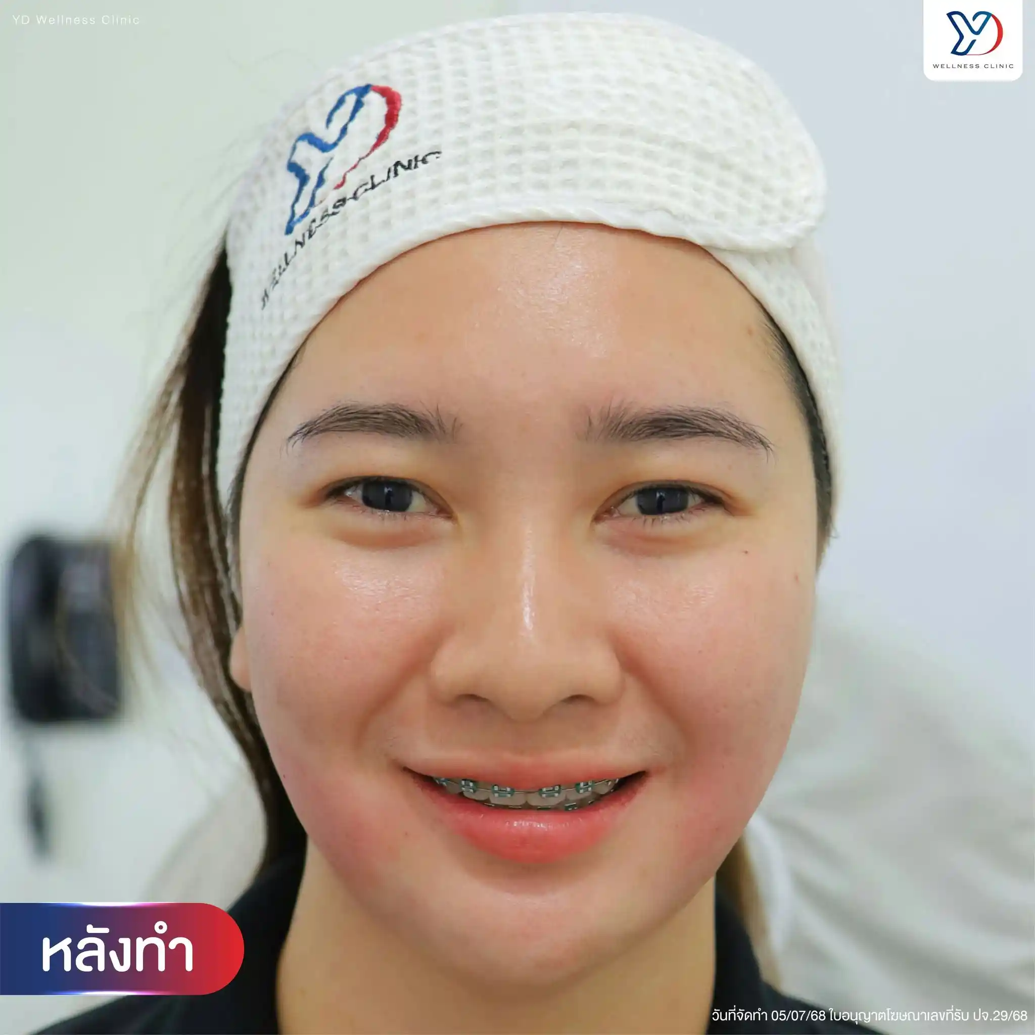 ดอลลี่อายช่วยเสริมมิติให้ใบหน้าและดวงตาอย่างไร