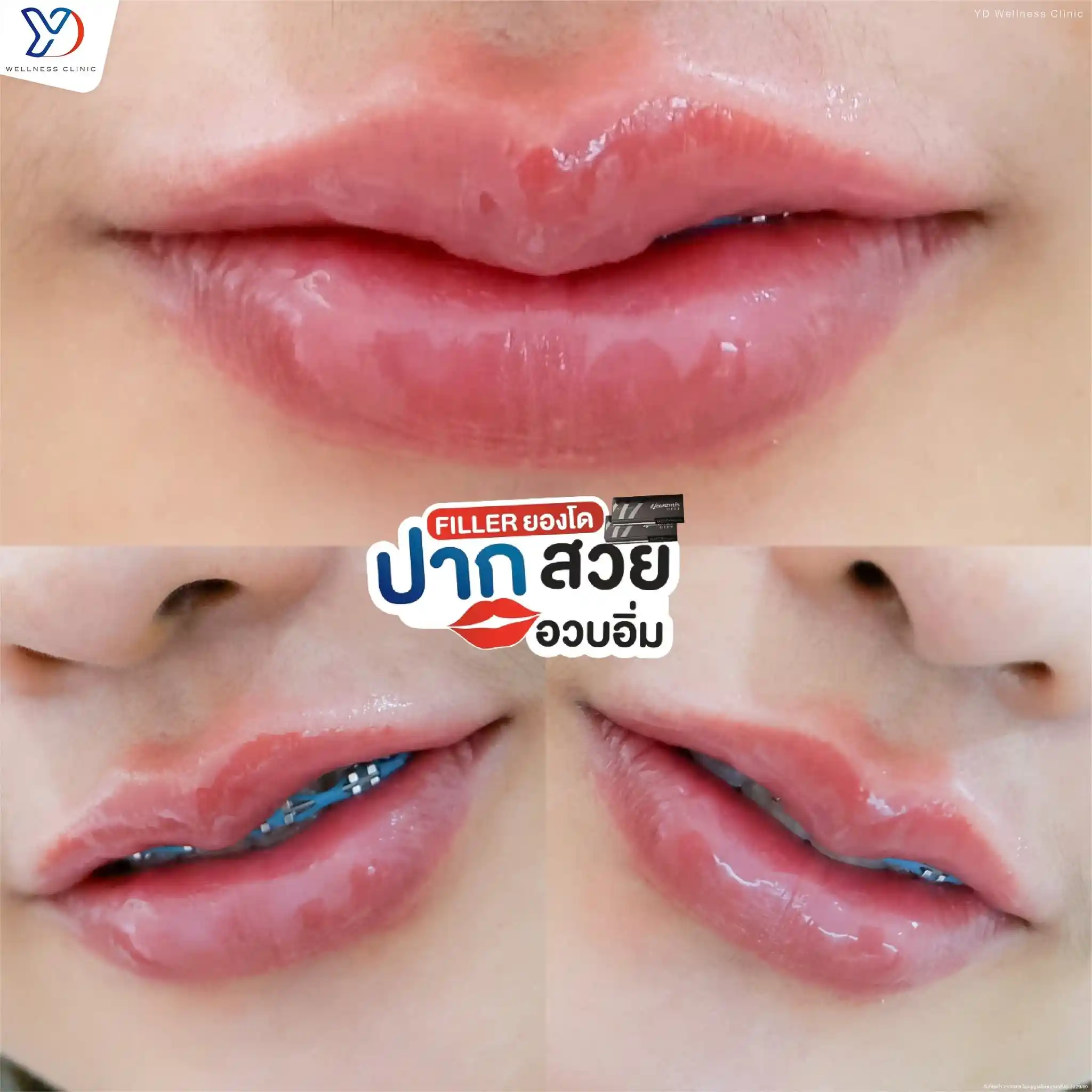 ทรงปากสวย ดูอย่างไร