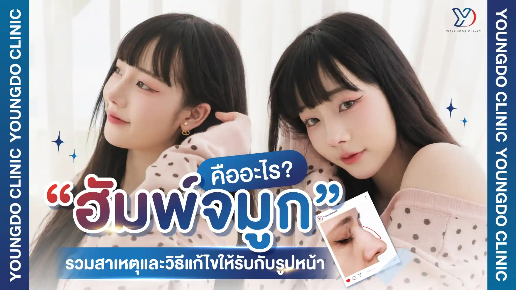 ฮัมพ์จมูกคืออะไร? รวมสาเหตุและวิธีแก้ไขให้รับกับรูปหน้า