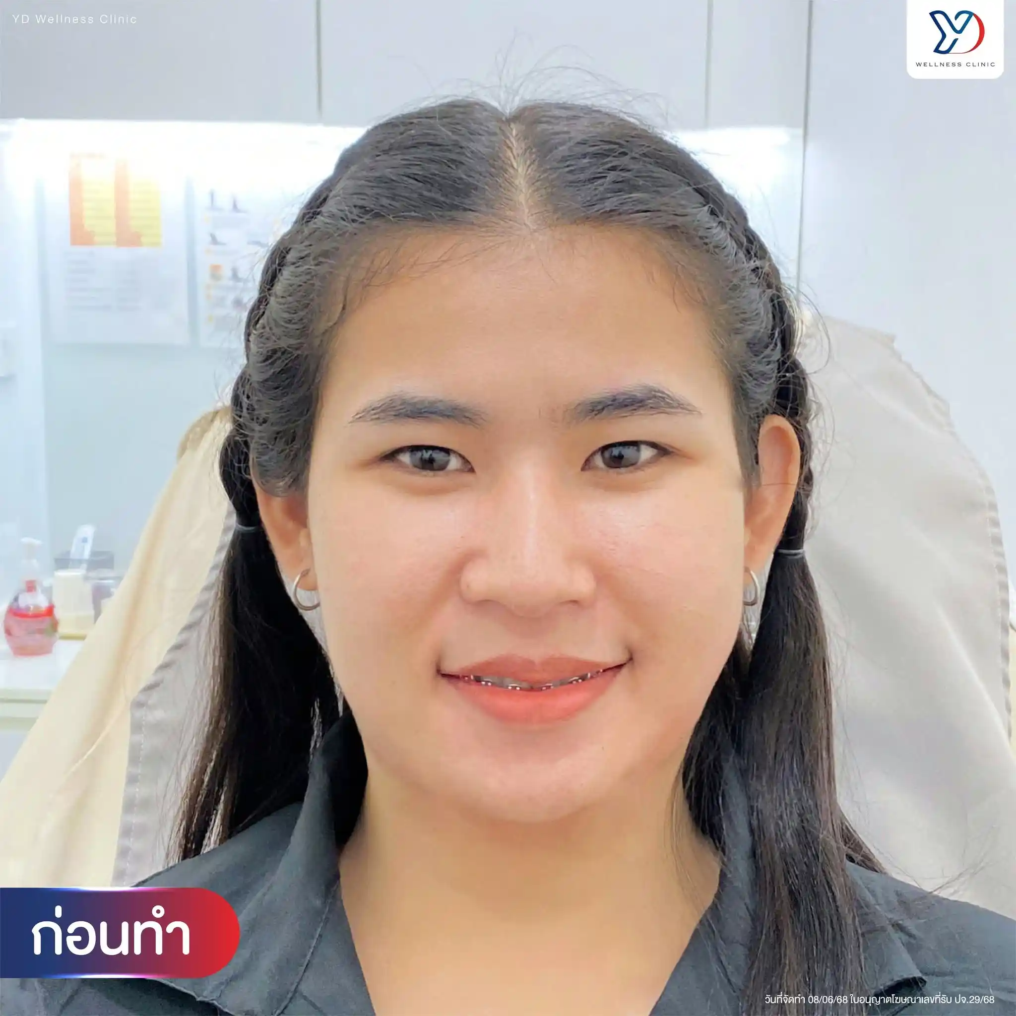 สภาพผิวแบบไหนที่เหมาะกับการทำมุลกวัง