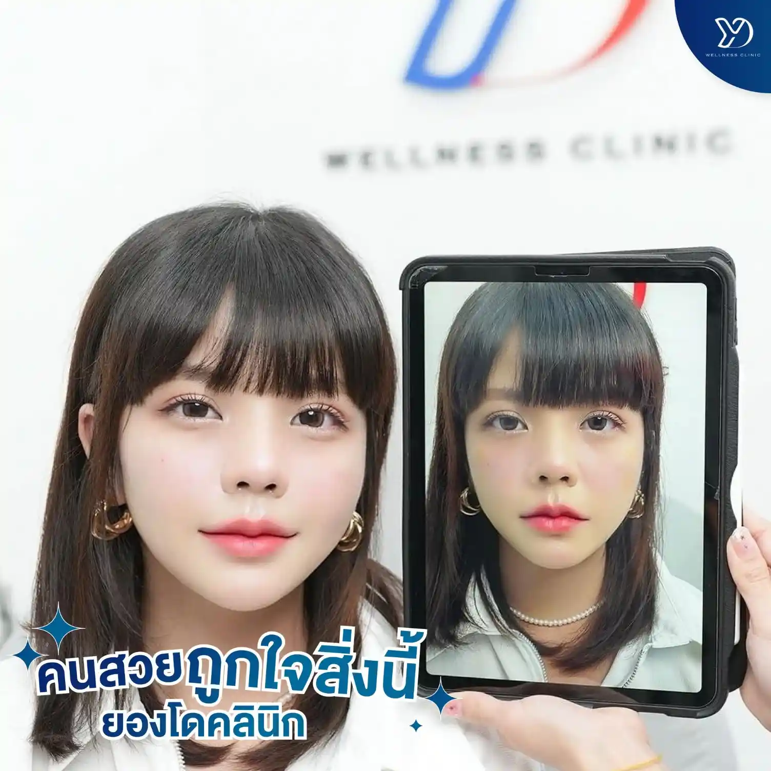 ดอลลี่อาย (Dolly Eyes) คืออะไร