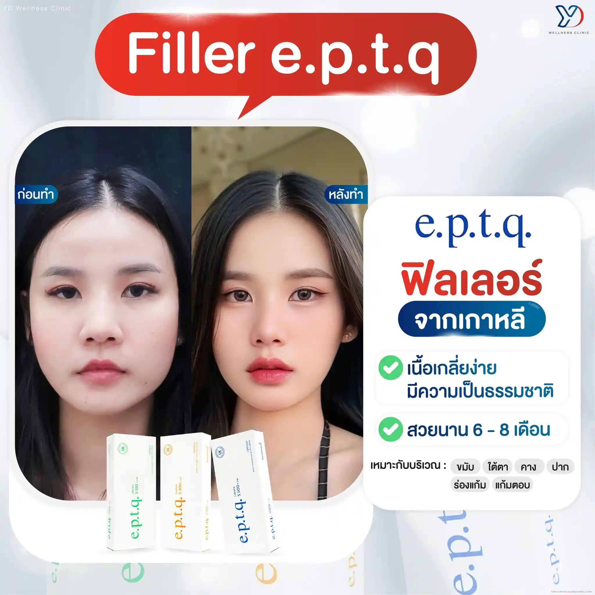 โปรแกรมฉีดฟิลเลอร์ e.p.t.q. คืออะไร