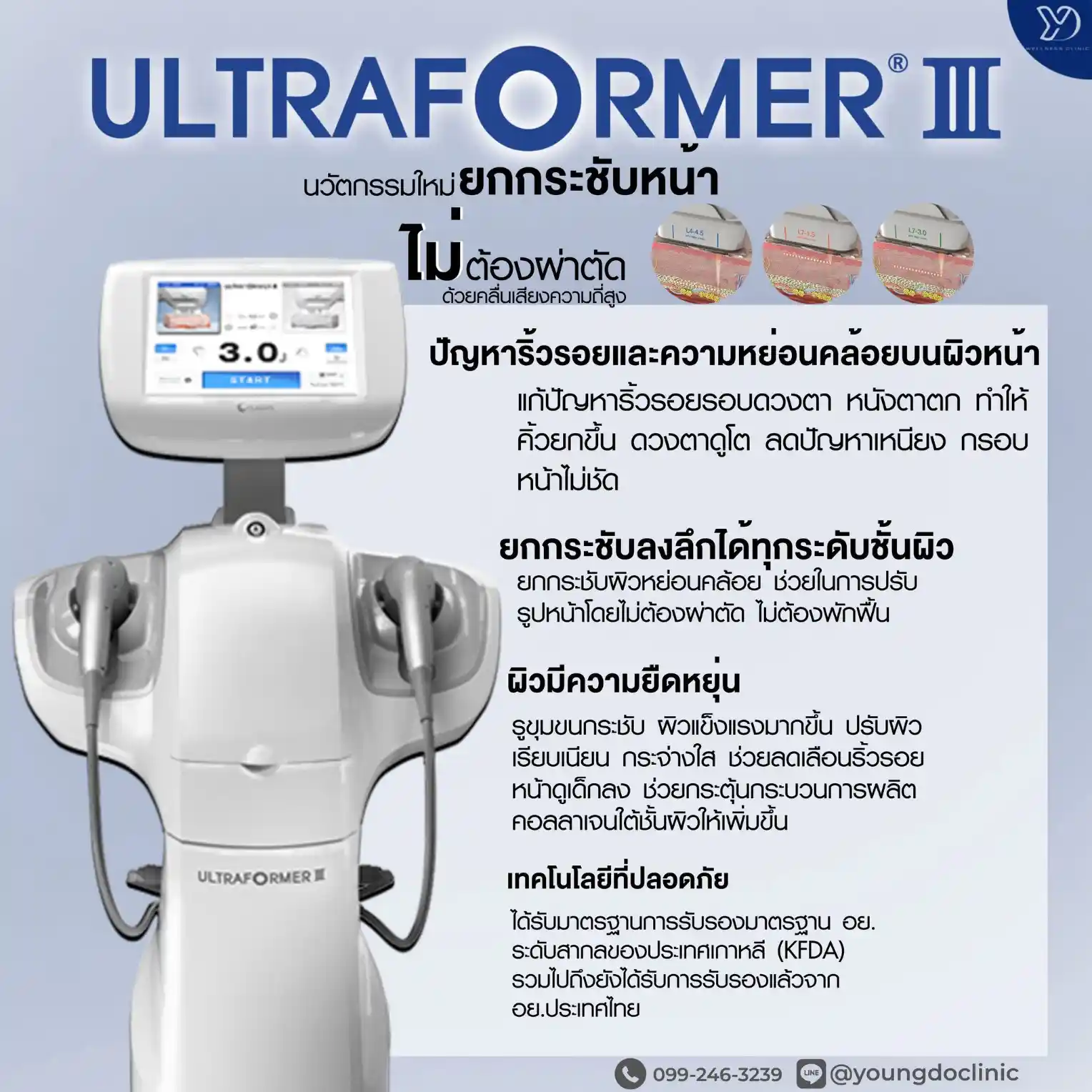 เครื่อง HIFU ยี่ห้อไหนดี