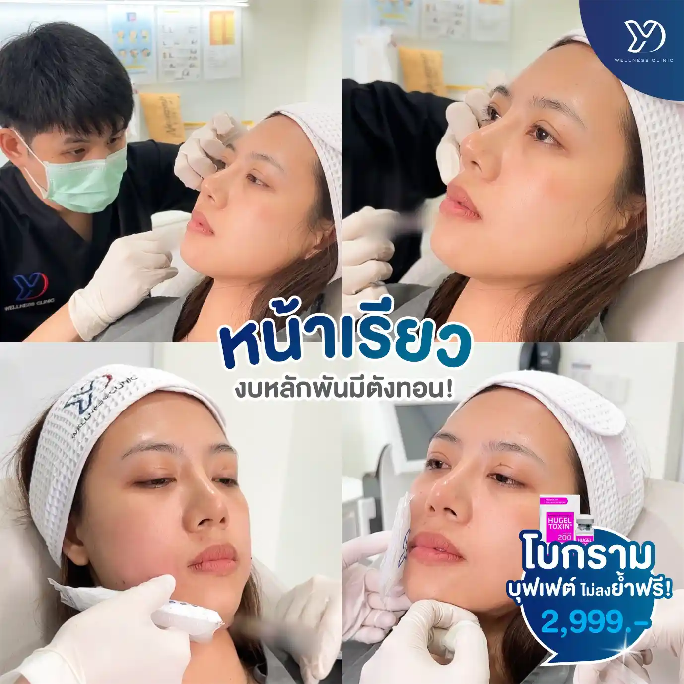 โปรแกรมโบท็อกซ์หน้าเรียว สระแก้ว ช่วยแก้ปัญหาอะไร