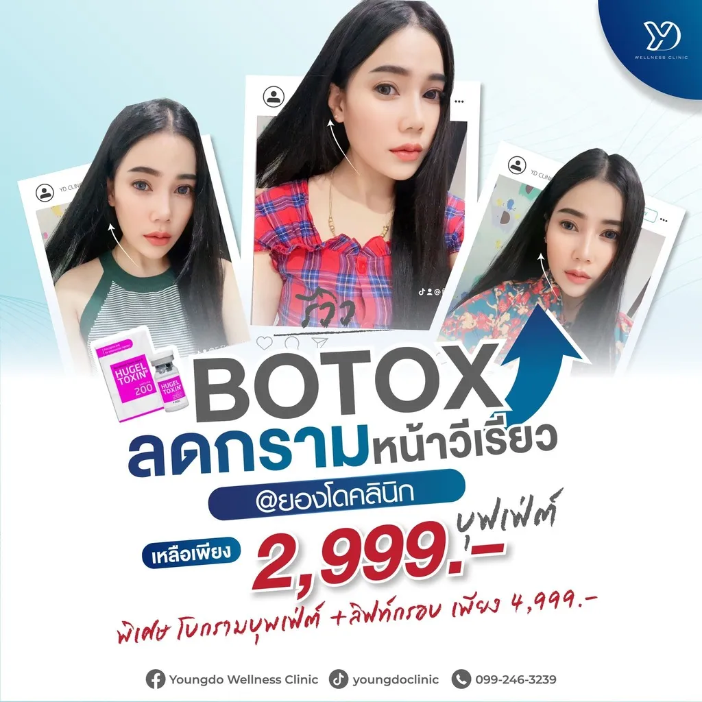 โปรแกรมโบท็อกซ์หน้าเรียว สระแก้ว ราคาเท่าไหร่