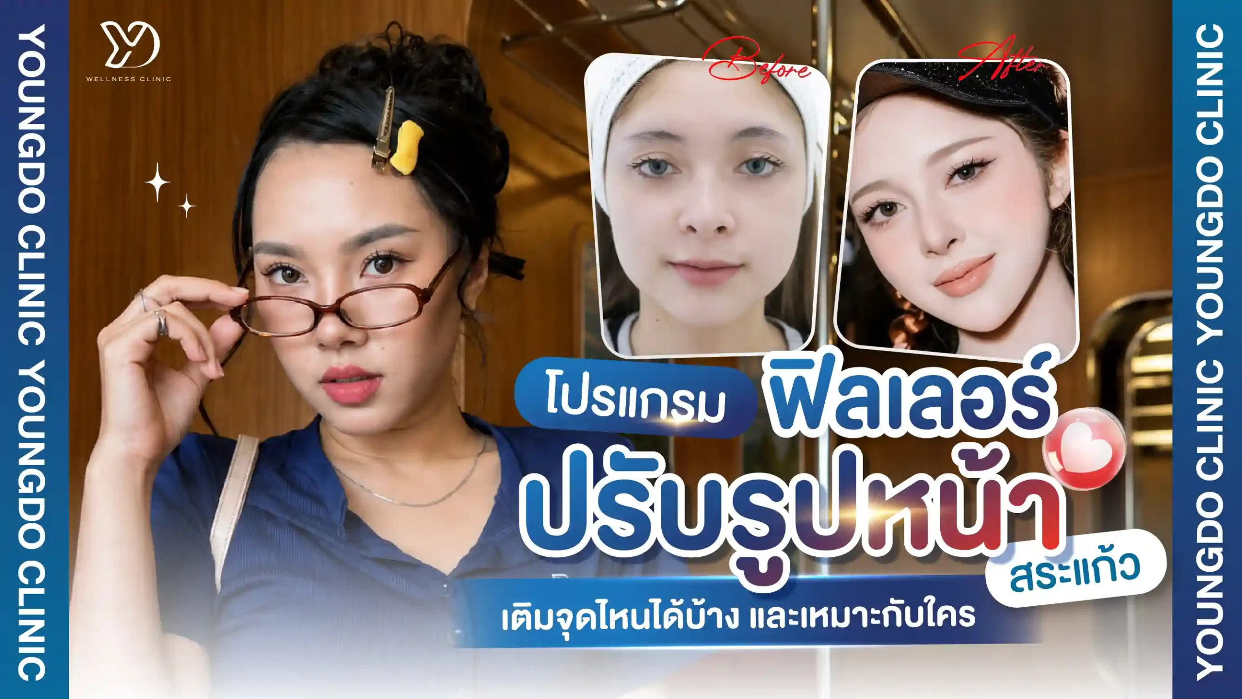 โปรแกรมฟิลเลอร์ปรับรูปหน้า สระแก้ว เติมจุดไหนได้บ้าง เหมาะกับใคร