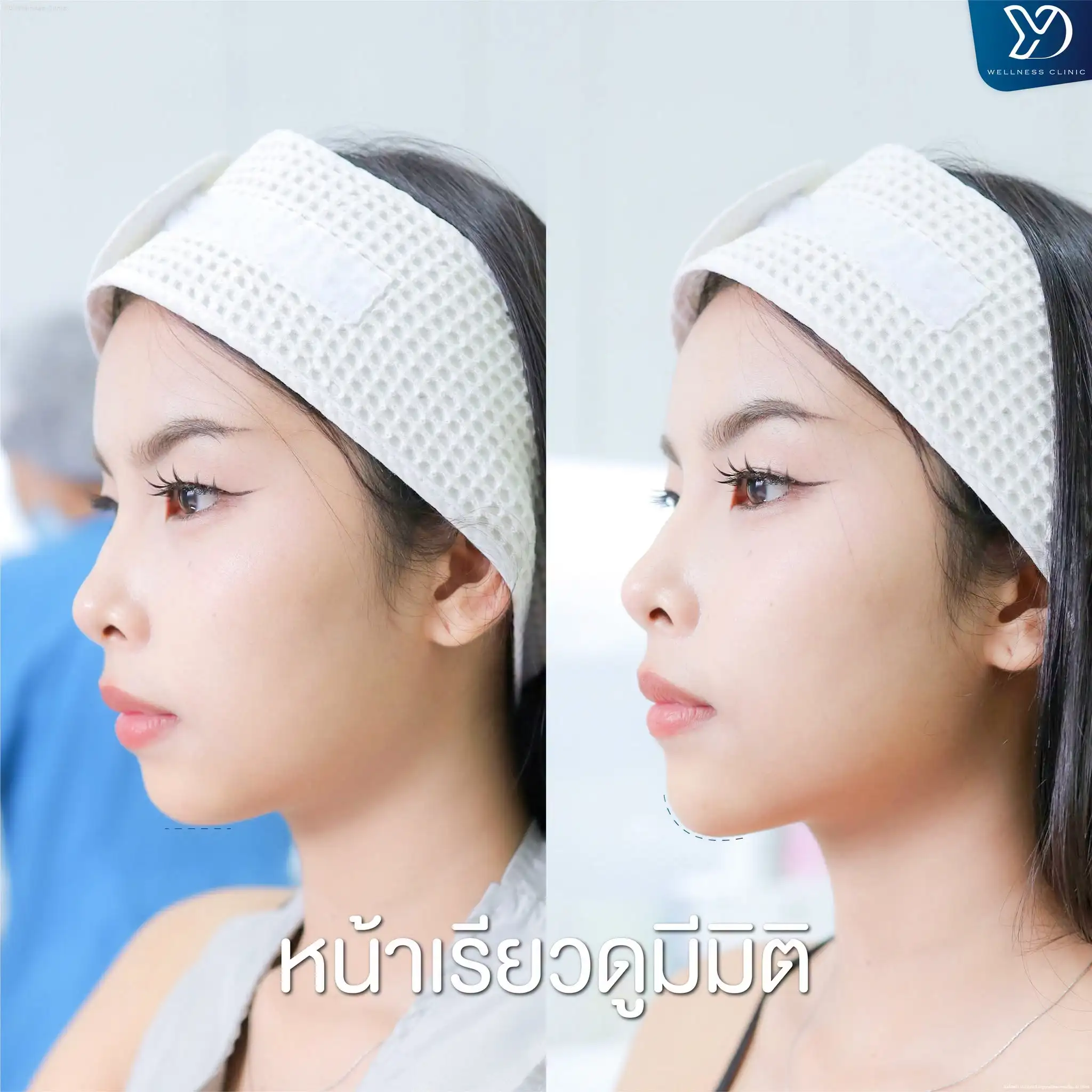 โปรแกรมฟิลเลอร์ปรับรูปหน้า สระแก้ว ช่วยแก้ปัญหาอะไร