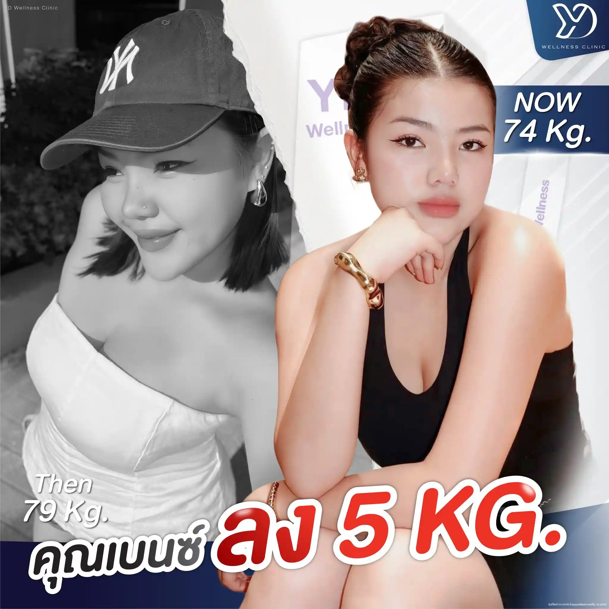 ปากกาลดน้ำหนักทำงานอย่างไร