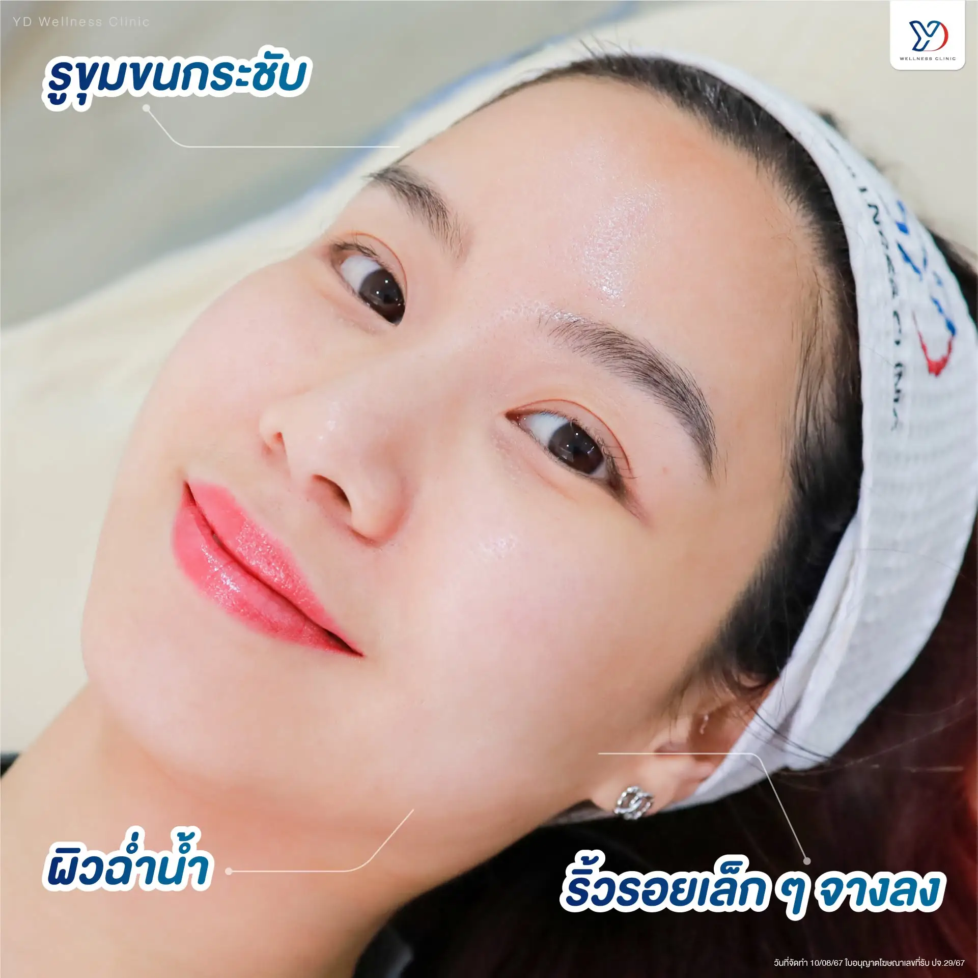 ฉีด Skin Booster สระแก้ว ที่ไหนดี