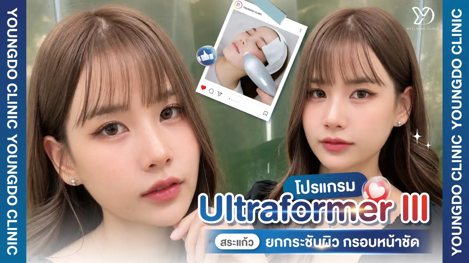 โปรแกรม Ultraformer III สระแก้ว ยกกระชับผิว กรอบหน้าชัด