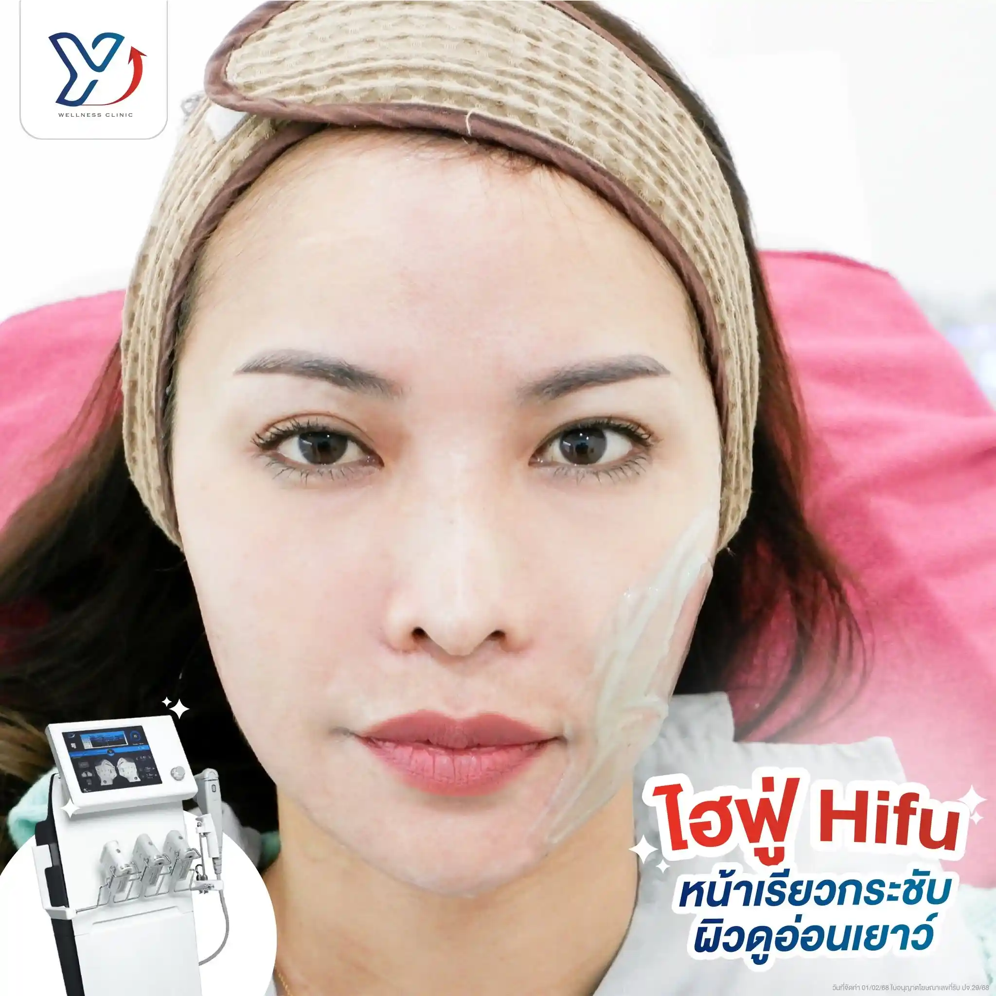 เครื่อง HIFU สระแก้ว คืออะไร