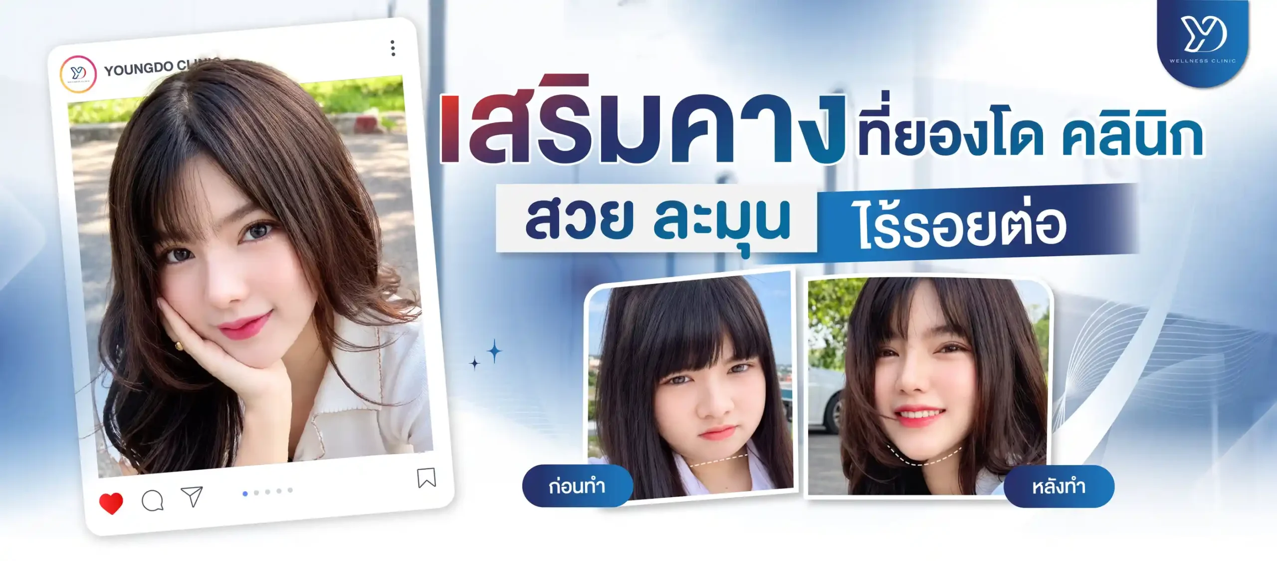 ปกเวริมคาง