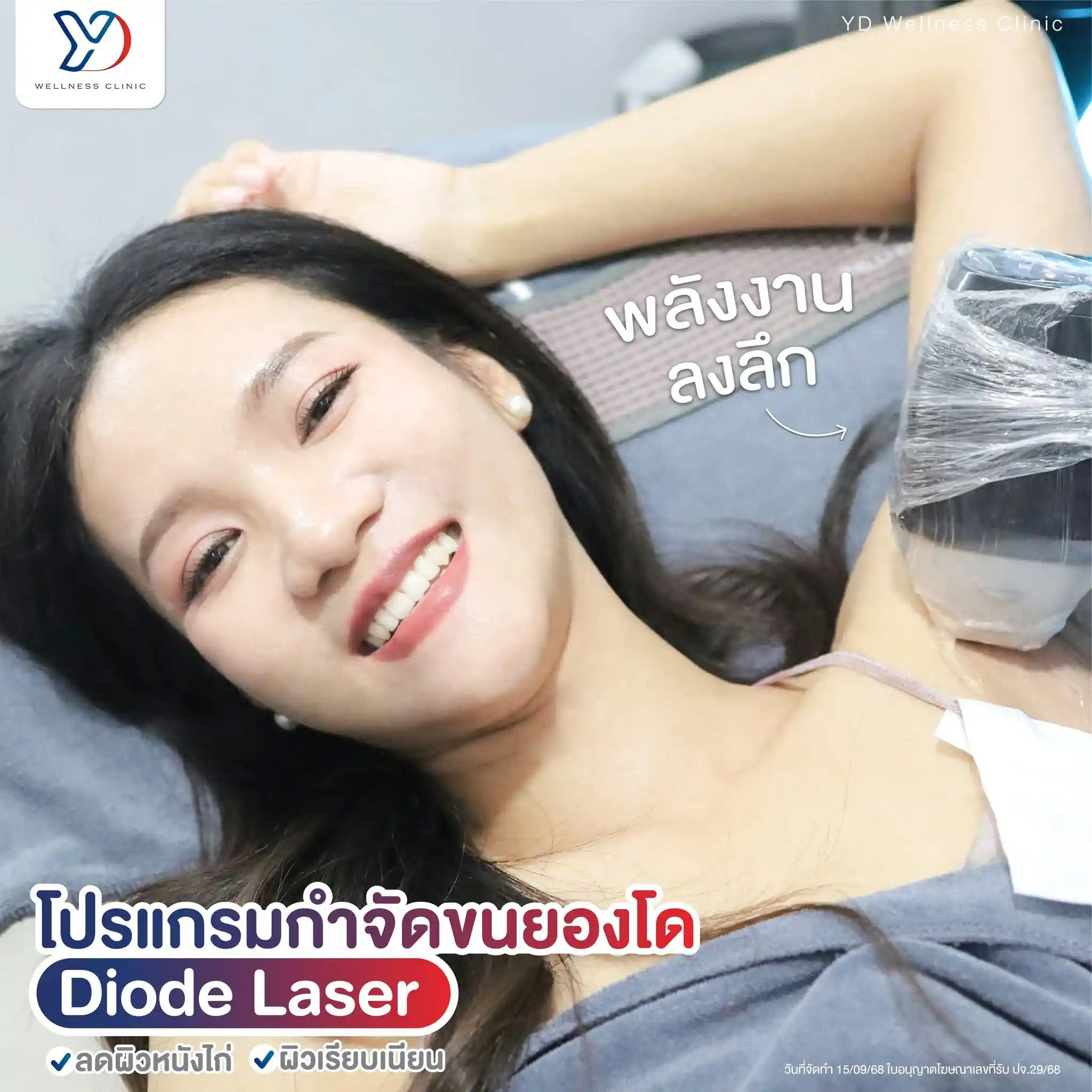 โปรแกรมกำจัดขน สระแก้ว