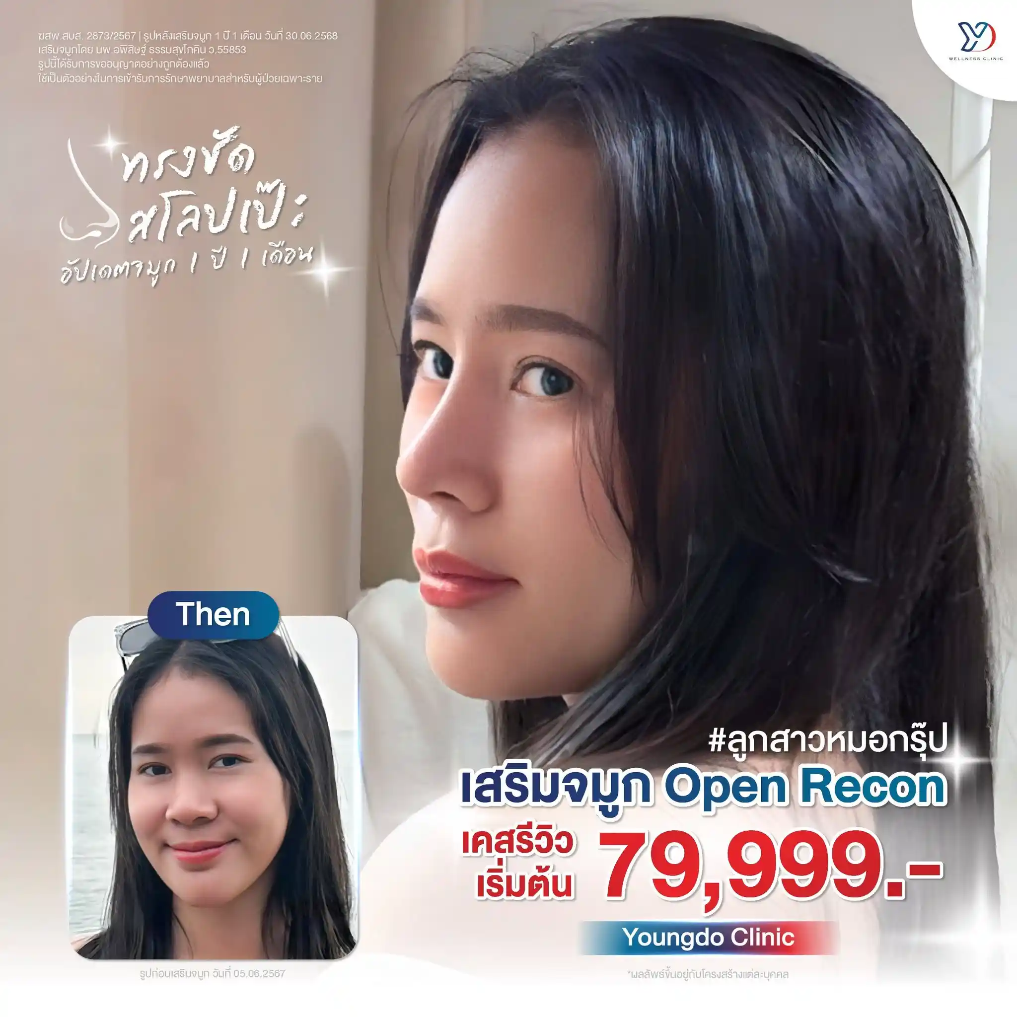 เทคนิค Open