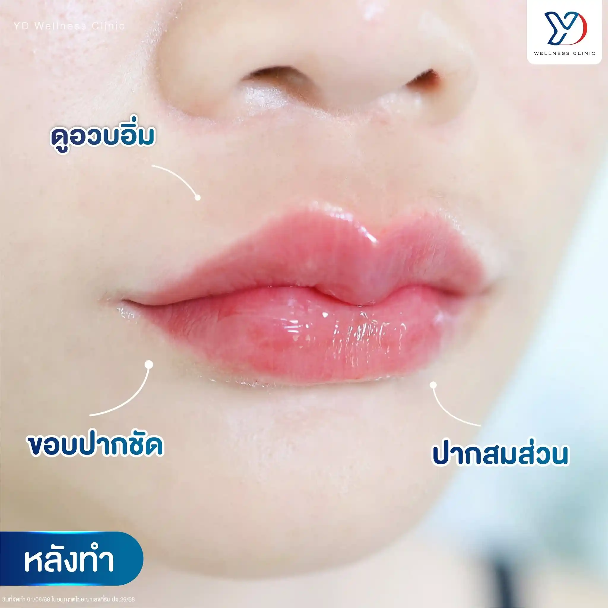 เคสรีวิว 03