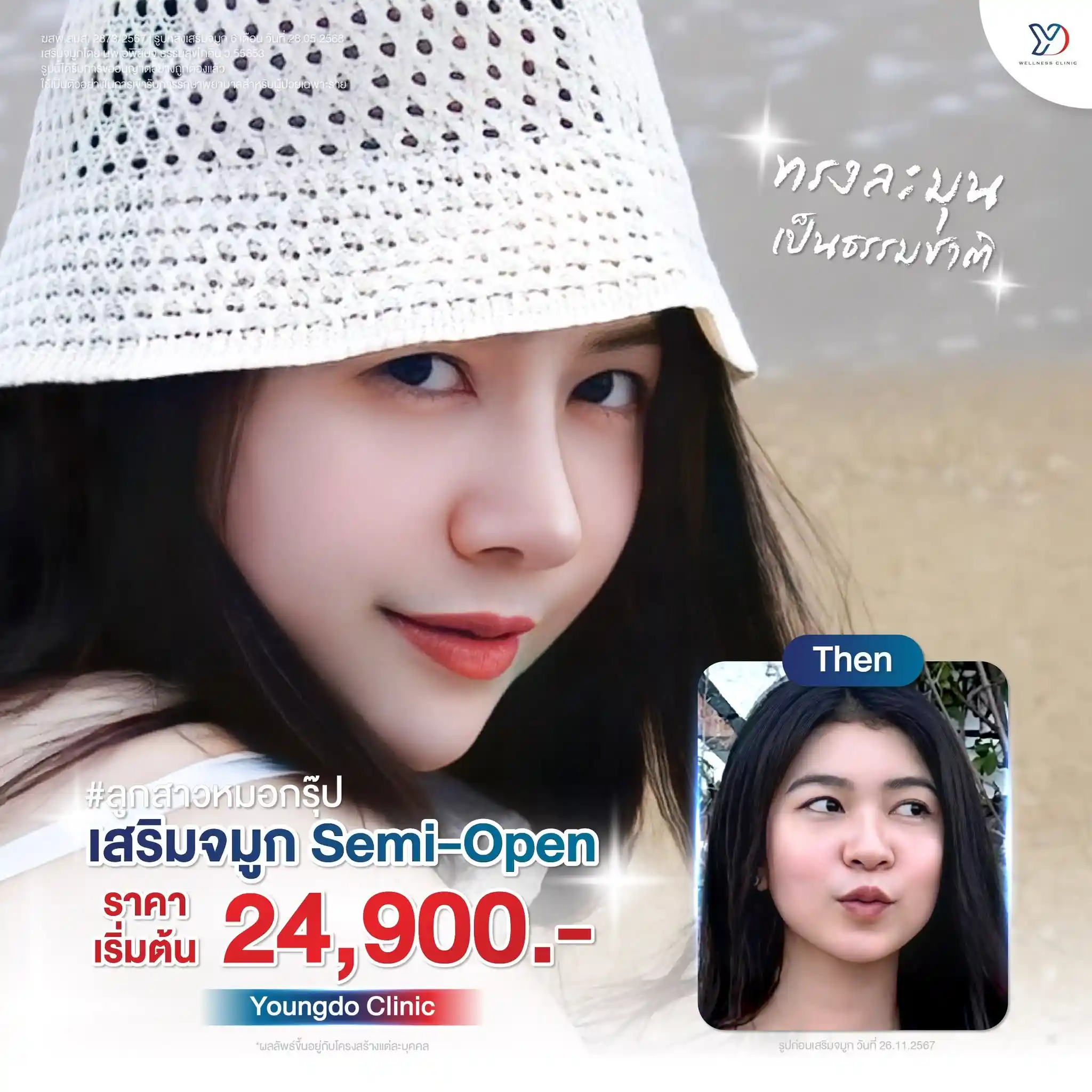 เทคนิค Semi-Open