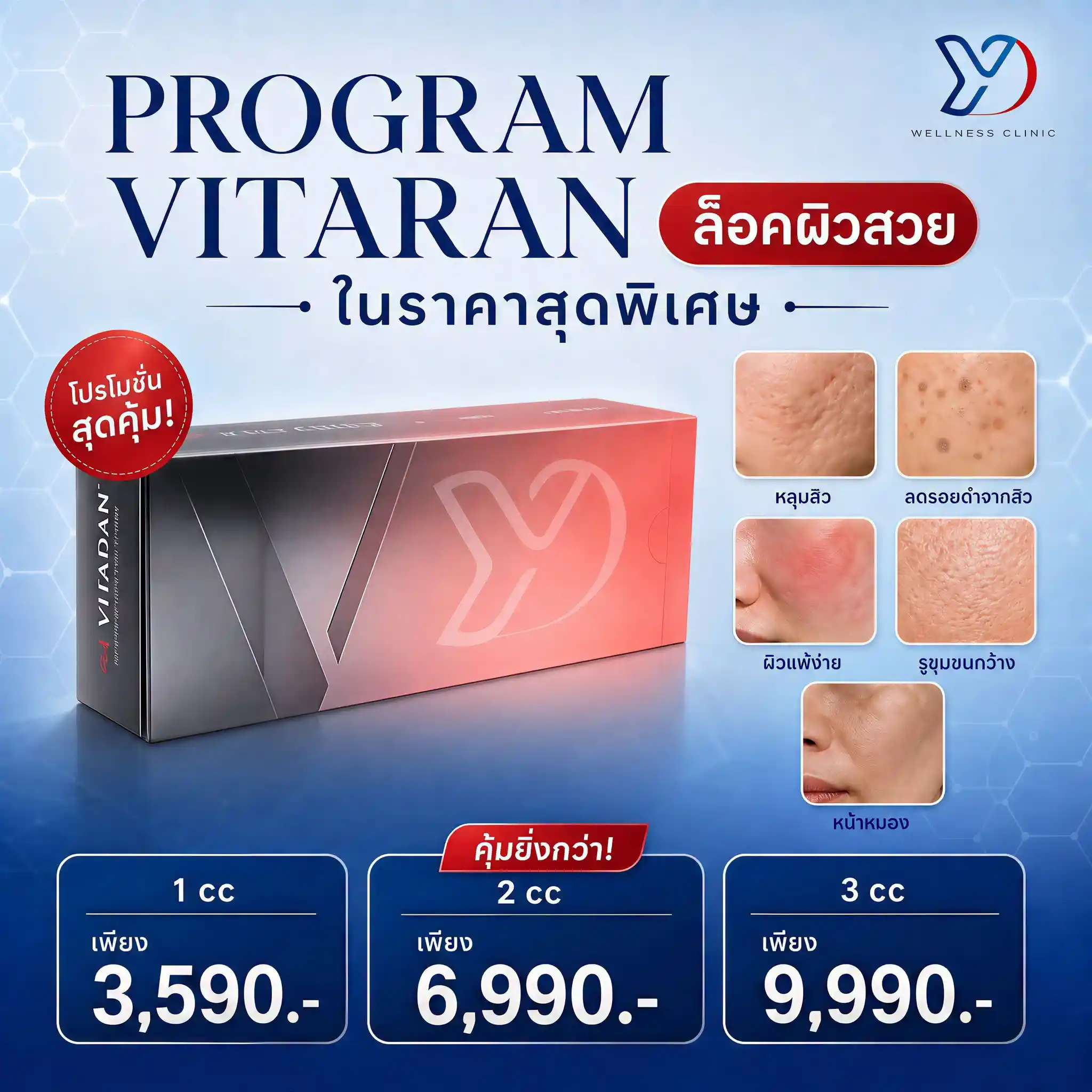 Vitaran ปราจีน ราคาเท่าไร