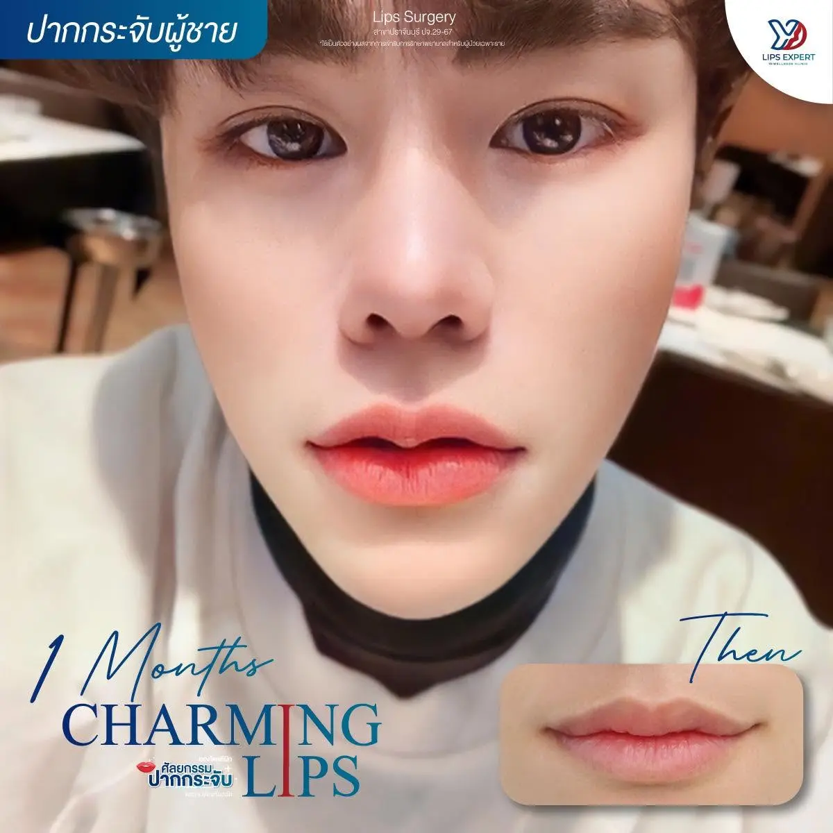 รีวิวปากกระจับผู้ชาย 05