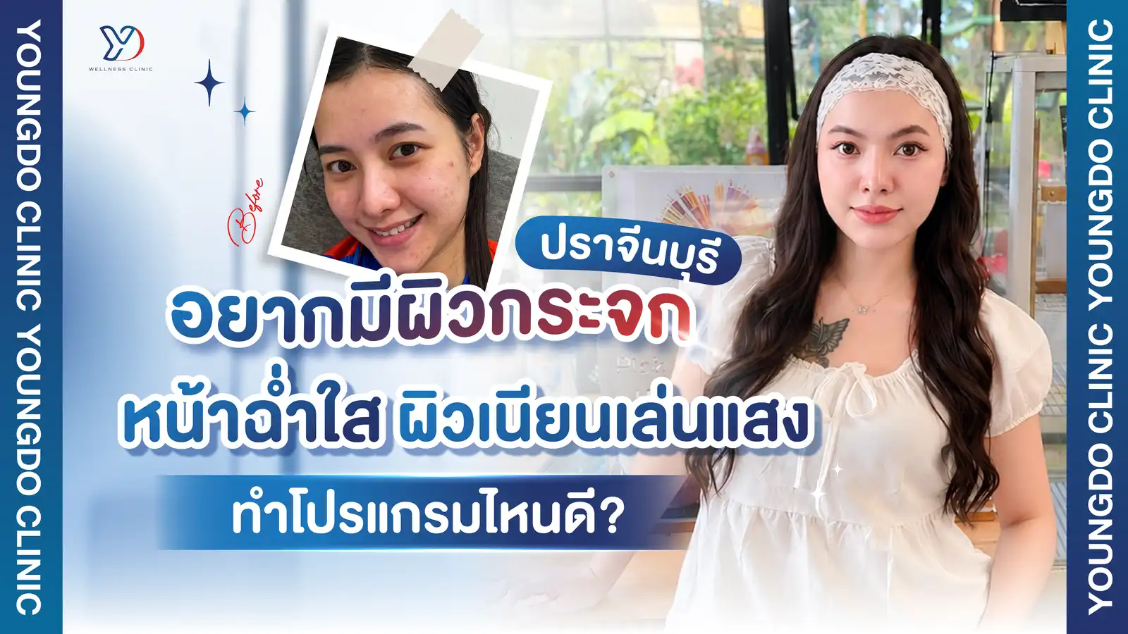 ผิวกระจก ปราจีนบุรี
