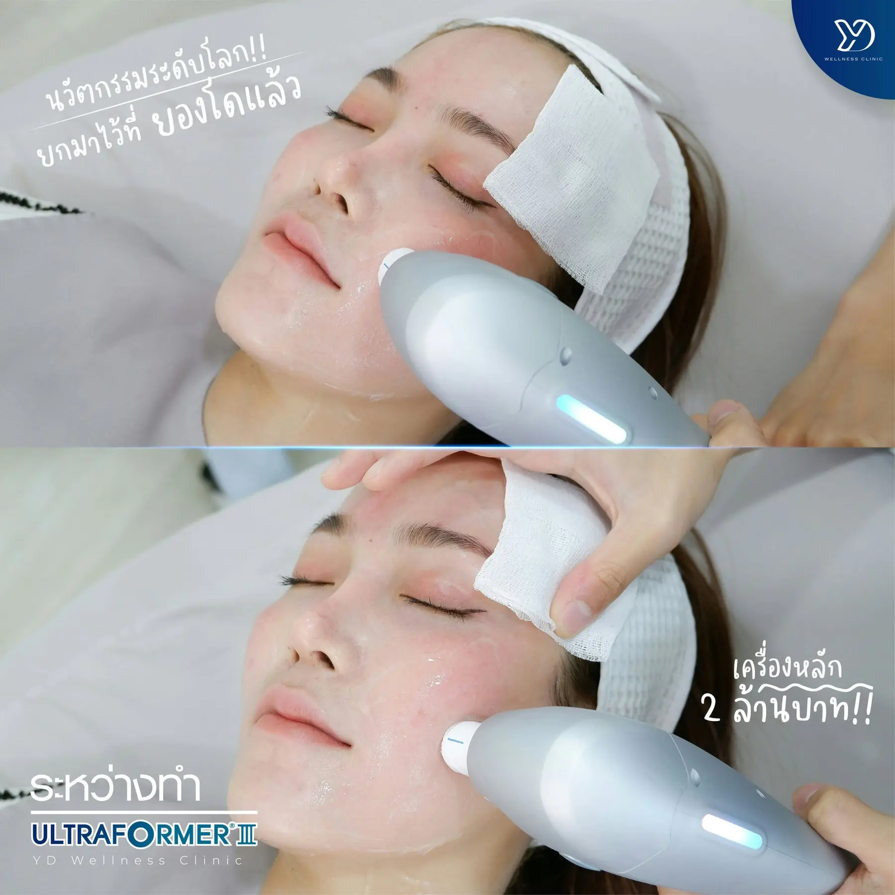 รีวิวโปรแกรมปรับหน้าอ่อนเยาว์ ที่ยองโด คลินิก 02