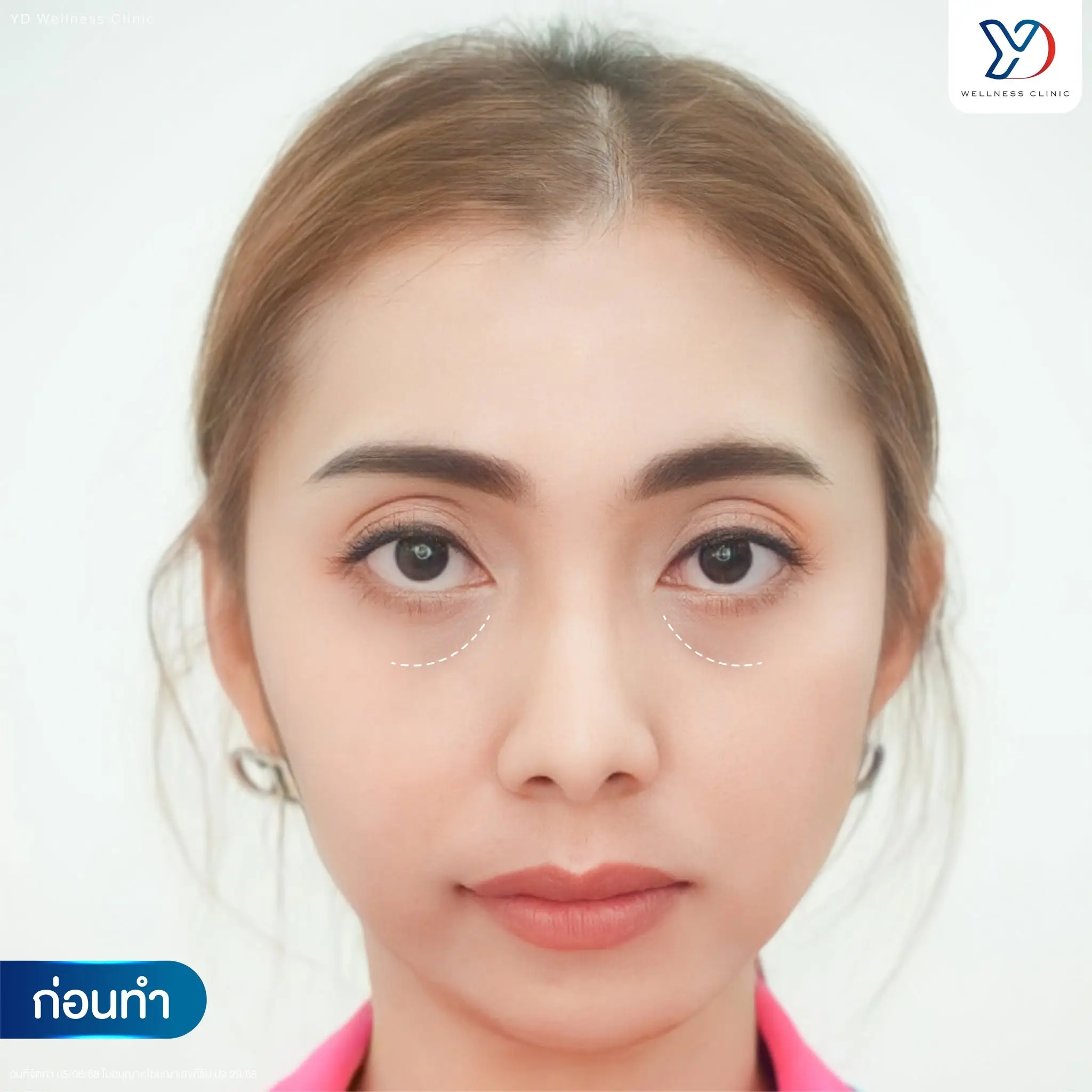 ทำไมบำรุงผิวแล้ว ยังไม่ได้ผิวกระจกอย่างที่ต้องการ